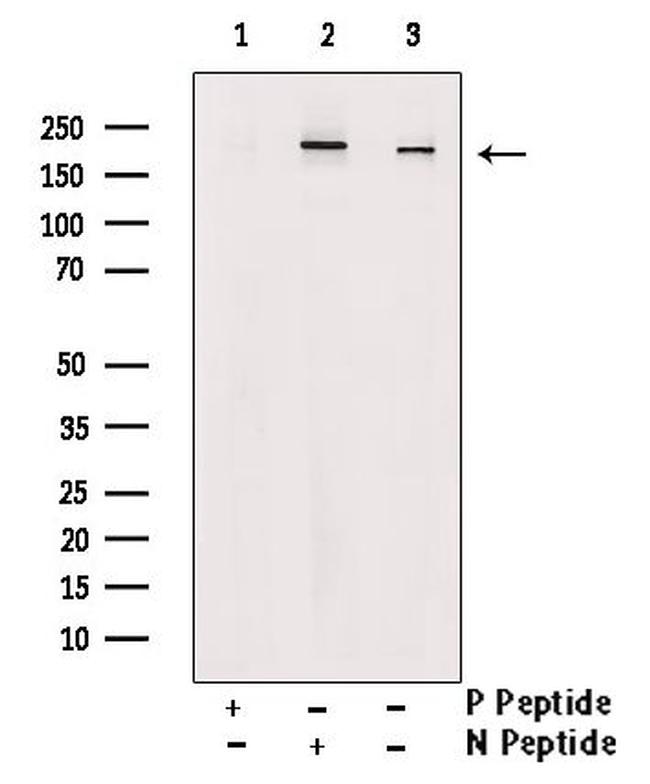 Phospho-KIF1B (Ser1057) Antibody in Western Blot (WB)