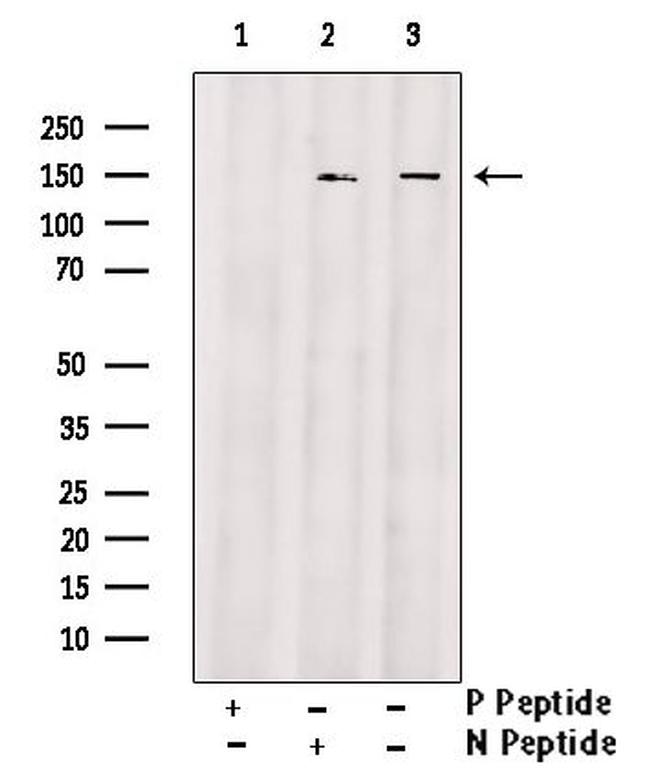 Phospho-AS160 (Ser341) Antibody in Western Blot (WB)