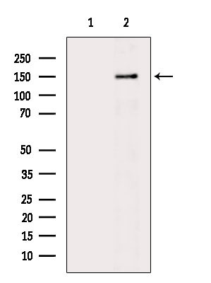 Phospho-AS160 (Ser570) Antibody in Western Blot (WB)