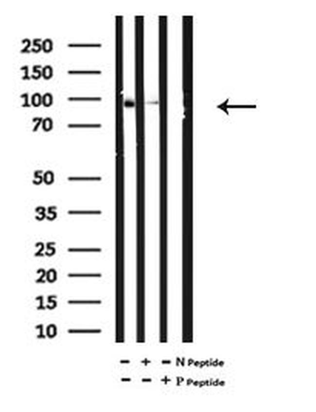 Phospho-TLR5 (Ser805) Antibody in Western Blot (WB)