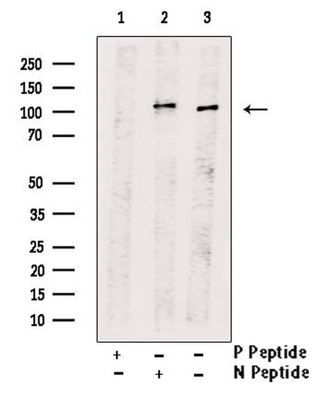 Phospho-IRE1 alpha (Tyr628) Antibody in Western Blot (WB)
