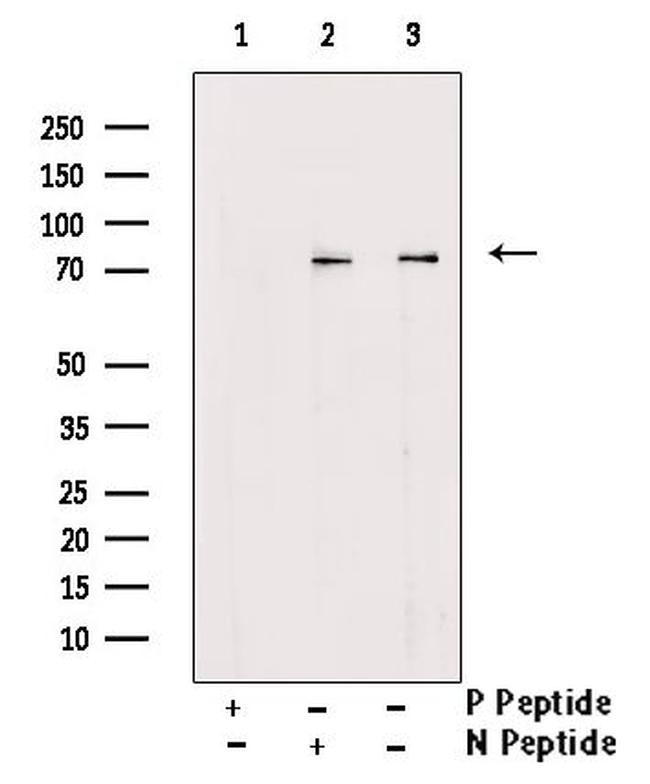 Phospho-PAK3 (Ser186) Antibody in Western Blot (WB)