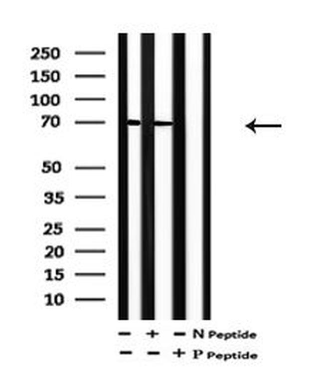 Phospho-PAK3 (Ser186) Antibody in Western Blot (WB)