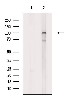 Phospho-KIF20A (Tyr869) Antibody in Western Blot (WB)