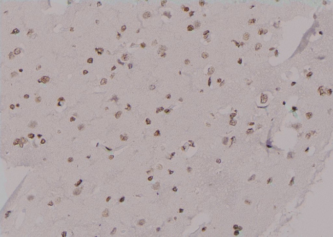 Phospho-KIF20A (Tyr869) Antibody in Immunohistochemistry (Paraffin) (IHC (P))