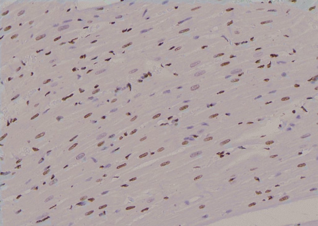 Phospho-KIF20A (Tyr869) Antibody in Immunohistochemistry (Paraffin) (IHC (P))