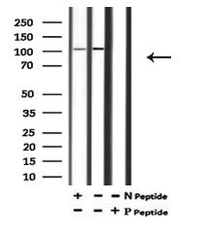 Phospho-ATP1A1 (Tyr542) Antibody in Western Blot (WB)