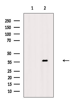 Phospho-NPM1 (Ser10) Antibody in Western Blot (WB)