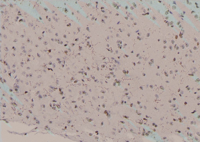 Phospho-HSP90 alpha (Tyr197) Antibody in Immunohistochemistry (Paraffin) (IHC (P))