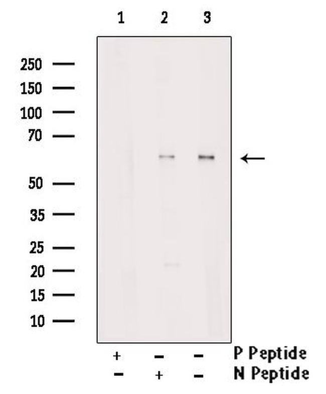 Phospho-Lyn (Tyr193) Antibody in Western Blot (WB)