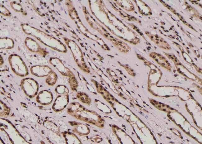 Phospho-E-cadherin (Tyr754) Antibody in Immunohistochemistry (Paraffin) (IHC (P))