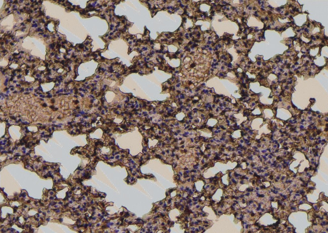 Phospho-E-cadherin (Tyr754) Antibody in Immunohistochemistry (Paraffin) (IHC (P))