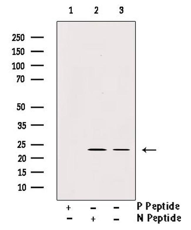 Phospho-TPT1 (Ser53) Antibody in Western Blot (WB)