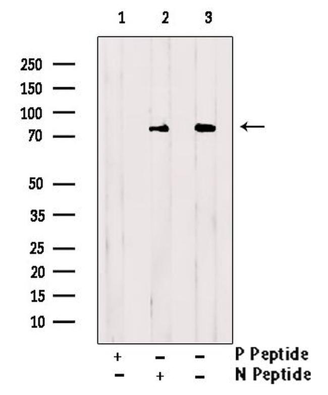 Phospho-HCLS1 (Tyr198) Antibody in Western Blot (WB)