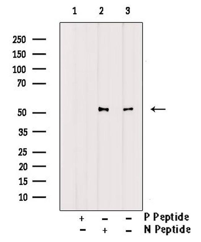 Phospho-GABRB1 (Ser409) Antibody in Western Blot (WB)