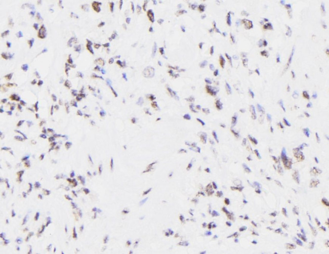 Phospho-EIF4B (Thr420) Antibody in Immunohistochemistry (Paraffin) (IHC (P))