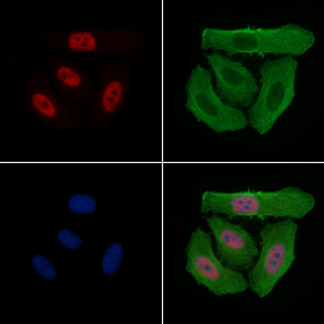 Phospho-RNA pol II CTD (Ser2, Ser5) Antibody in Immunocytochemistry (ICC/IF)