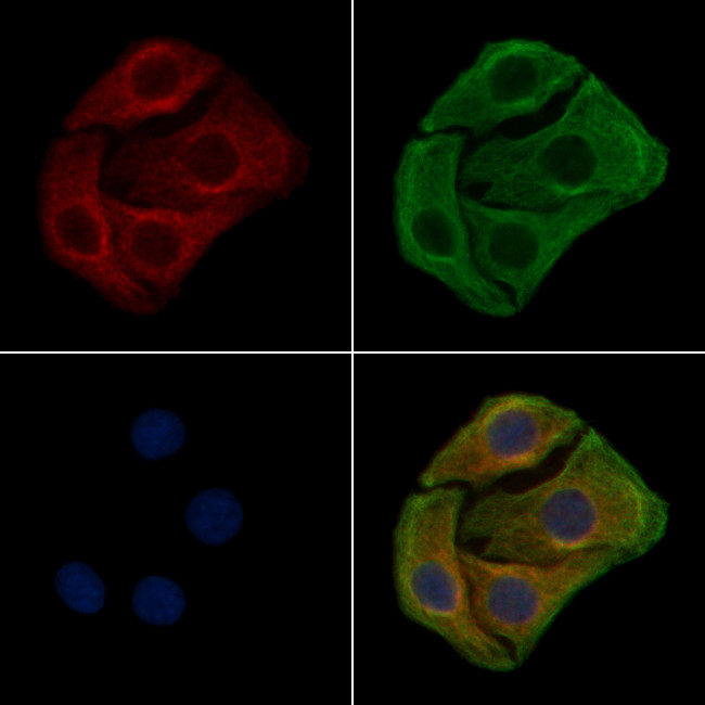 Phospho-EphA2 (Tyr594) Antibody in Immunocytochemistry (ICC/IF)