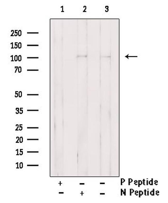 Phospho-EphA2 (Tyr772) Antibody in Western Blot (WB)