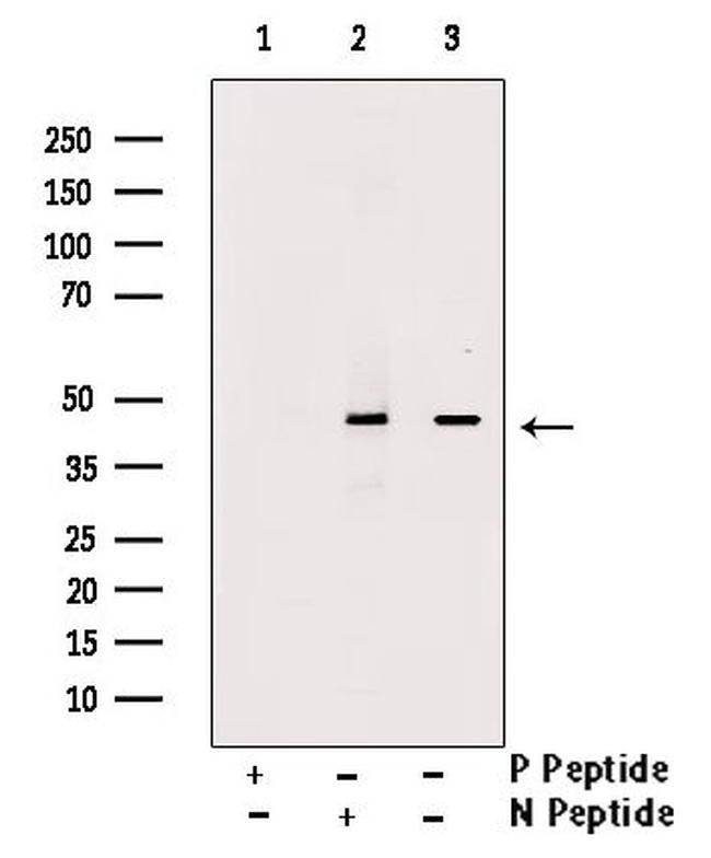 Phospho-TDP-43 (Ser409) Antibody in Western Blot (WB)