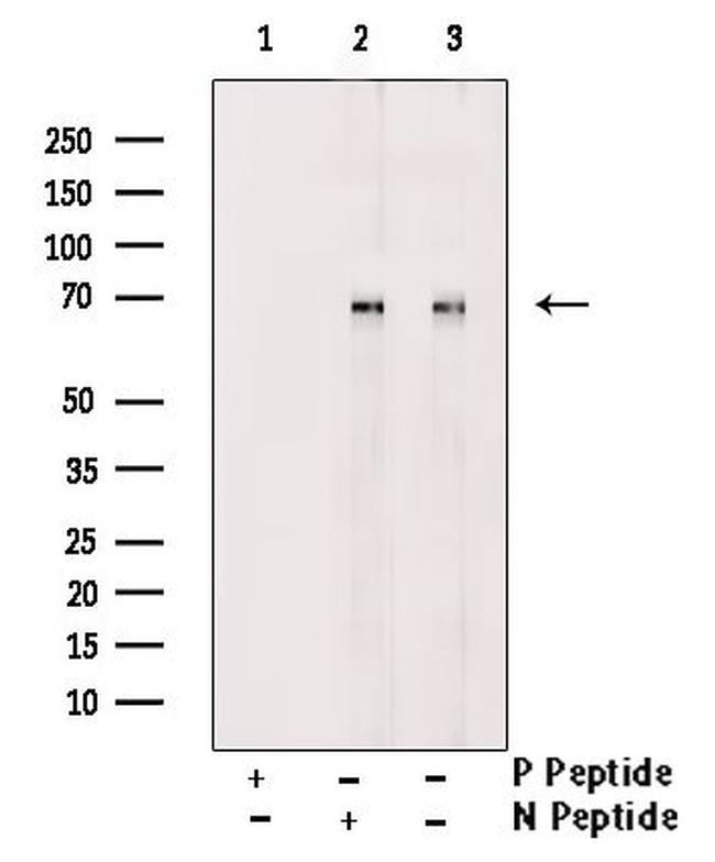 Phospho-GRB10 (Ser431) Antibody in Western Blot (WB)