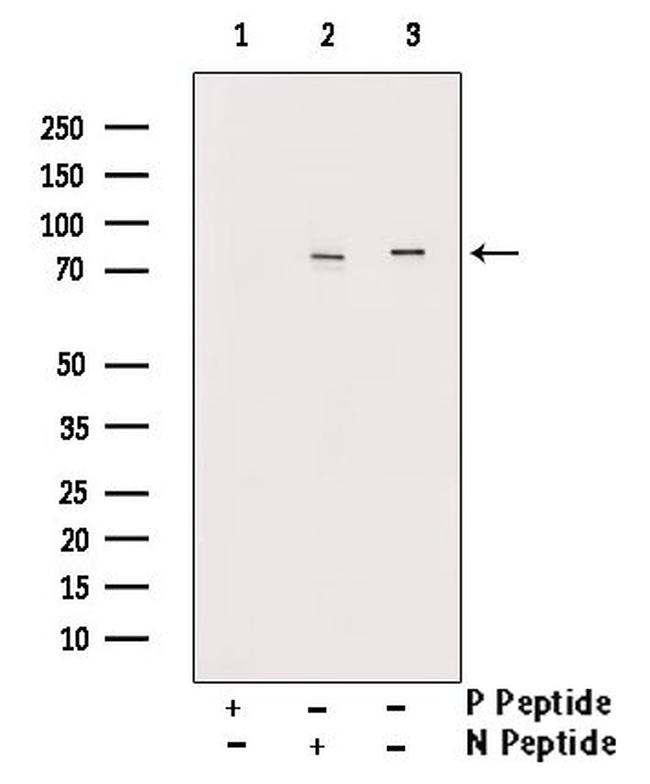 Phospho-RIP1 (Ser161) Antibody in Western Blot (WB)