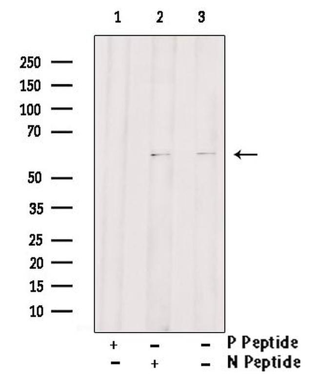 Phospho-Beclin 1 (Ser90, Ser93, Ser96) Antibody in Western Blot (WB)