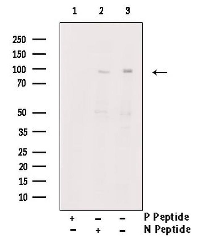 Phospho-NFATC4 (Ser289) Antibody in Western Blot (WB)