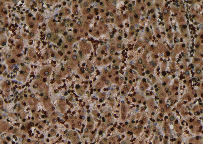 Phospho-EphA7 (Tyr614) Antibody in Immunohistochemistry (Paraffin) (IHC (P))