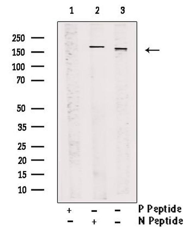 Phospho-NCOA2 (Ser698, Ser699) Antibody in Western Blot (WB)
