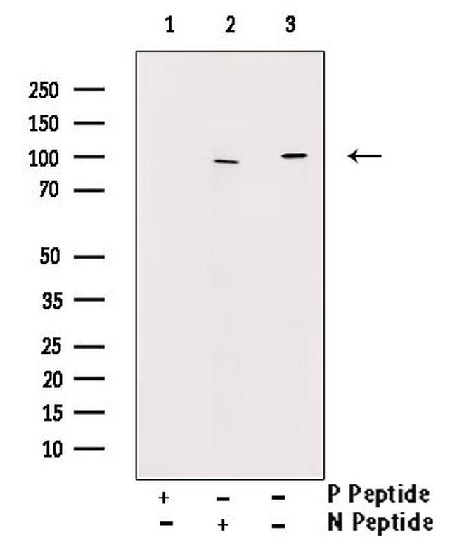 Phospho-PSD93 (Tyr348) Antibody in Western Blot (WB)