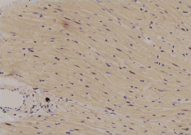 Phospho-C/EBP epsilon (Ser181) Antibody in Immunohistochemistry (Paraffin) (IHC (P))