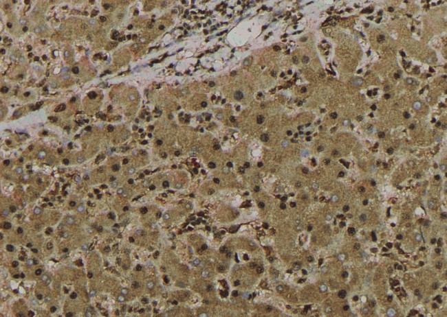 Phospho-EZH2 (Ser363, Ser366) Antibody in Immunohistochemistry (Paraffin) (IHC (P))