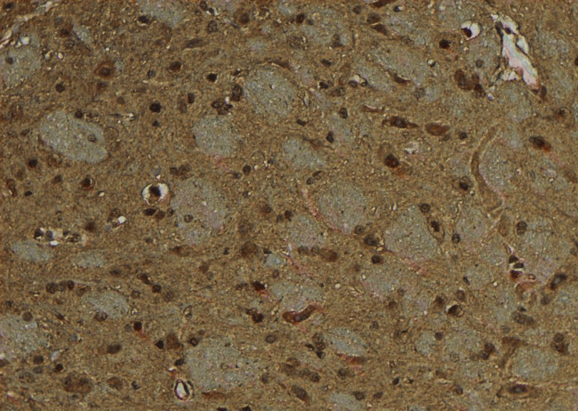 Phospho-EZH2 (Ser363, Ser366) Antibody in Immunohistochemistry (Paraffin) (IHC (P))