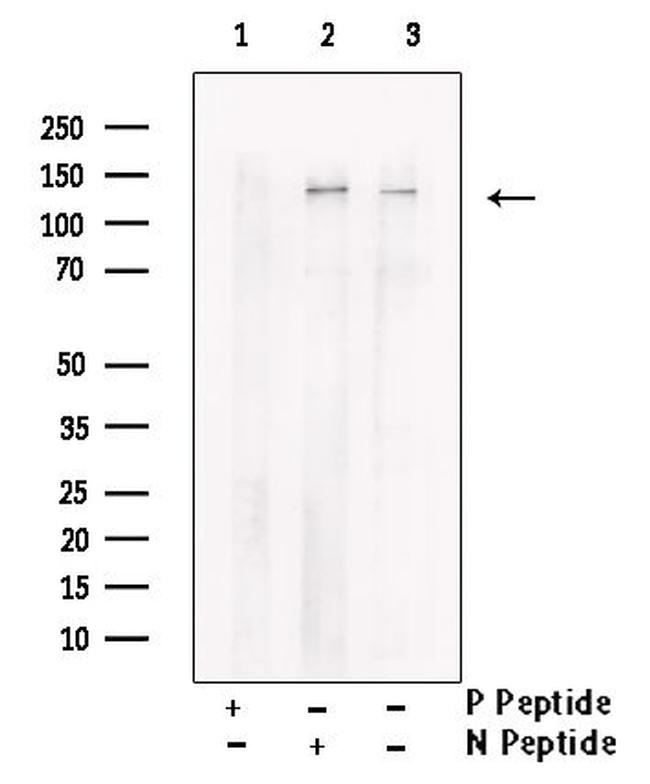 Phospho-TBC1D1 (Ser627) Antibody in Western Blot (WB)