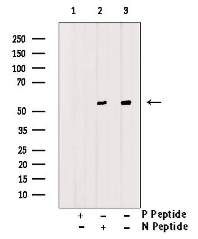 Phospho-ATG14 (Thr429) Antibody in Western Blot (WB)