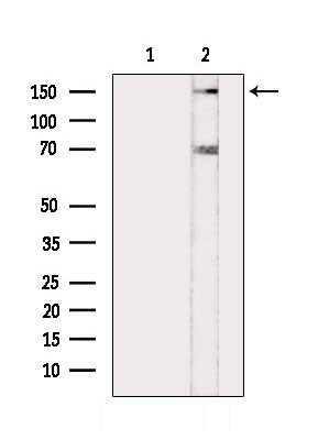 Phospho-BCL9L (Ser21 ) Antibody in Western Blot (WB)