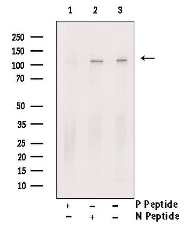 Phospho-KSR1 (Ser569) Antibody in Western Blot (WB)