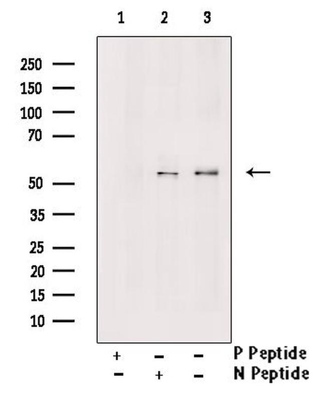 Phospho-MLKL (Ser125) Antibody in Western Blot (WB)