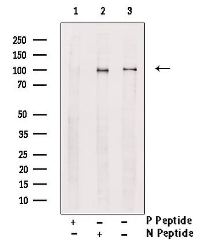 Phospho-VPS34 (Ser244, Ser249) Antibody in Western Blot (WB)