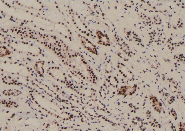 Phospho-PRAS40 (Ser202) Antibody in Immunohistochemistry (Paraffin) (IHC (P))