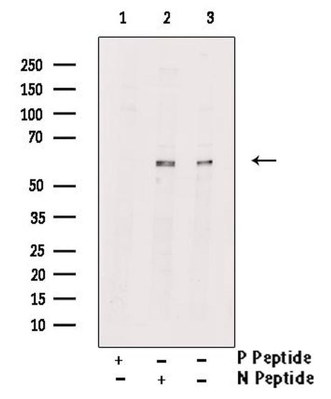 Phospho-RIP3 (Ser232) Antibody in Western Blot (WB)