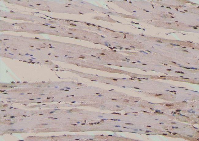 Phospho-RyR2 (Ser2808) Antibody in Immunohistochemistry (Paraffin) (IHC (P))