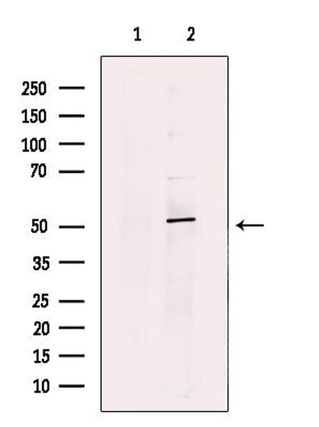 CTDSPL2 Antibody in Western Blot (WB)
