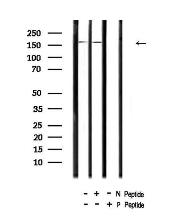 Phospho-PDGFRB (Tyr1009) Antibody in Western Blot (WB)