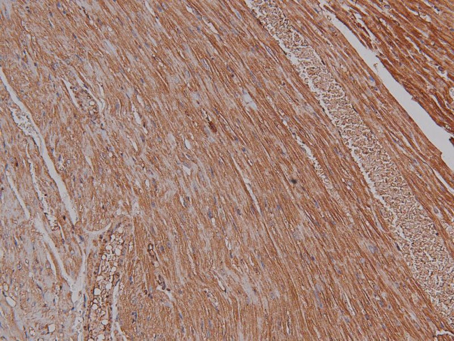 Phospho-PKA alpha (Ser339) Antibody in Immunohistochemistry (Paraffin) (IHC (P))