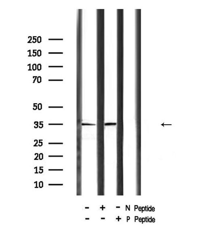 Phospho-PKA alpha (Ser339) Antibody in Western Blot (WB)