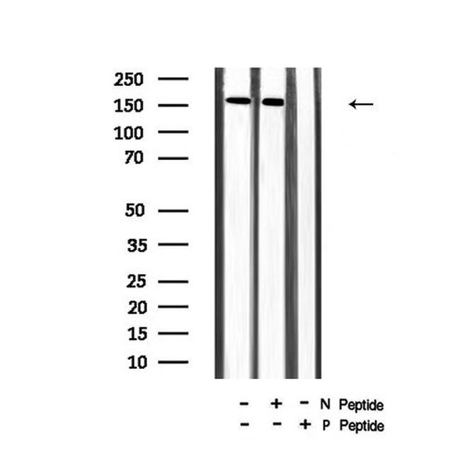 Phospho-VEGF Receptor 2 (Tyr996) Antibody in Western Blot (WB)