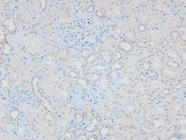 Phospho-HSL (Ser660) Antibody in Immunohistochemistry (Paraffin) (IHC (P))