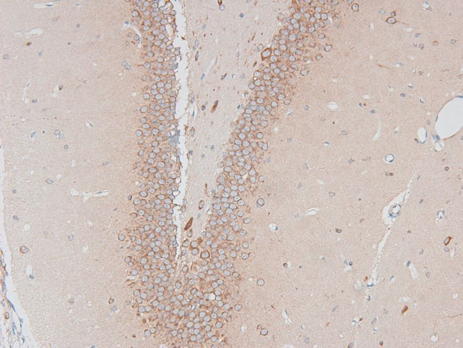 Phospho-HSL (Ser660) Antibody in Immunohistochemistry (Paraffin) (IHC (P))